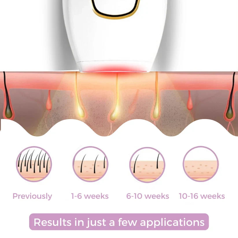 IPL Hair Remover