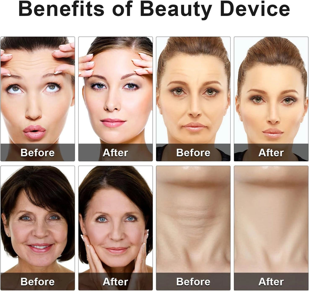 Anti-Wrinkle Face Roller