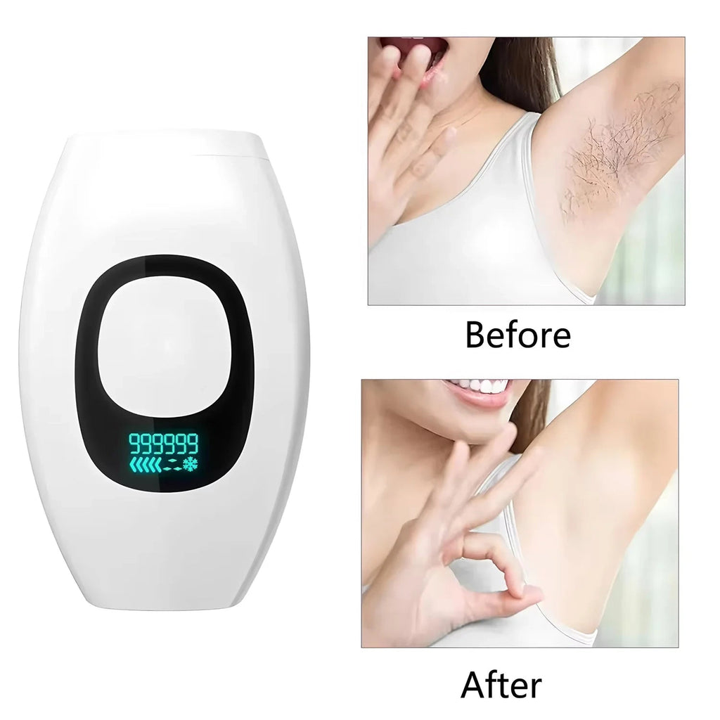IPL Hair Remover