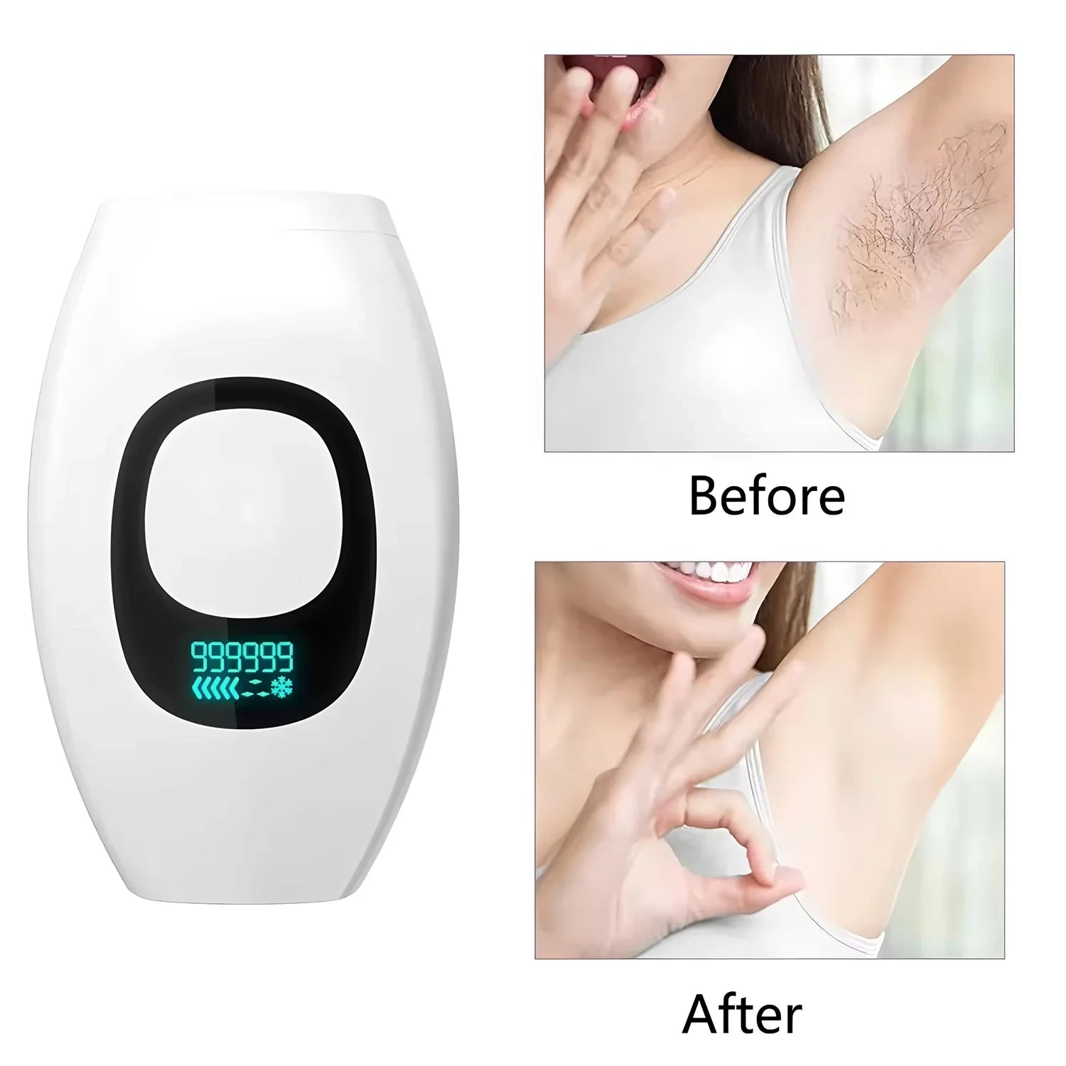 IPL Hair Remover